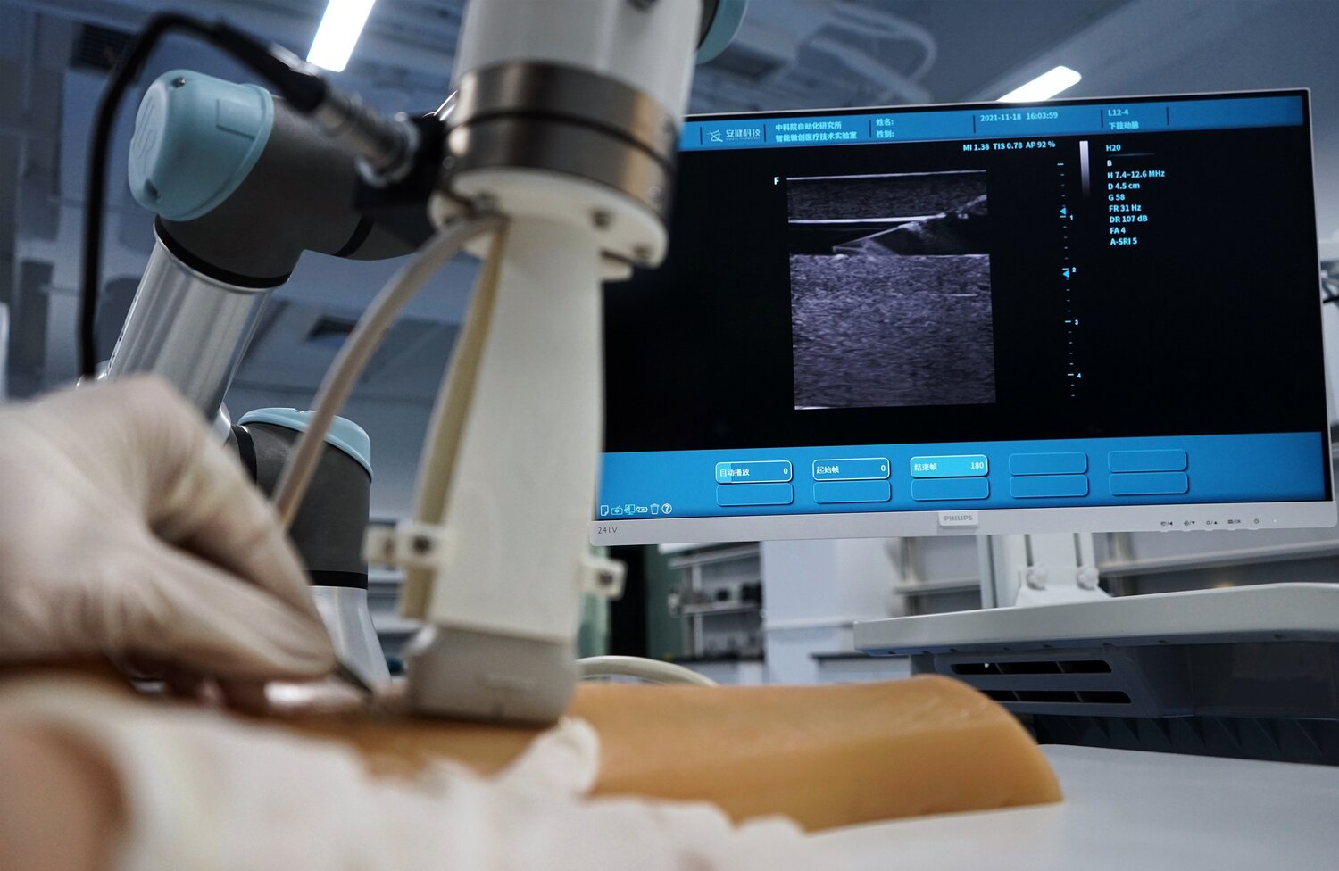 Assistive robot for ultrasound-guided Treatment: CAIR is developing novel robotic systems to assist precise treatment under the guidance  of ultrasound. The purpose is to allow intelligent and accurate positioning of both the ultrasound probe and the treatment device. As a result, the system will provide simple means of controlling conventional devices, allow less-skilled operators to perform the procedure, and achieve required clinical outcomes for precise treatment.